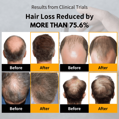 BETTERMEN Hair Growth Oil