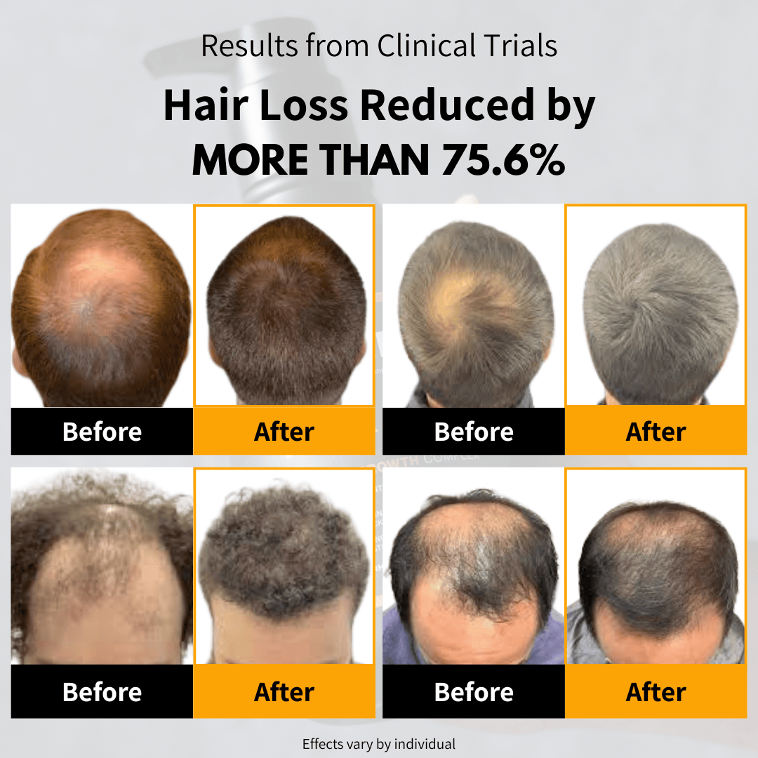 BETTERMEN Anti Hair Loss Shampoo