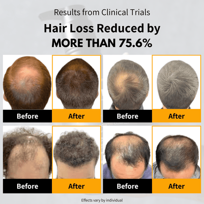 BETTERMEN Anti Hair Loss Shampoo