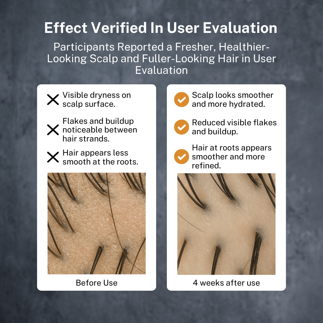 BETTERMEN Anti Hair Loss Shampoo