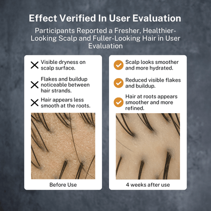 BETTERMEN Anti Hair Loss Shampoo